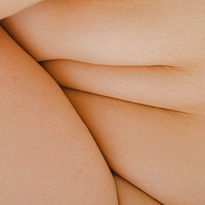 Closeup of rolls on a woman's body
