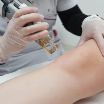 A technician performing laser hair removal